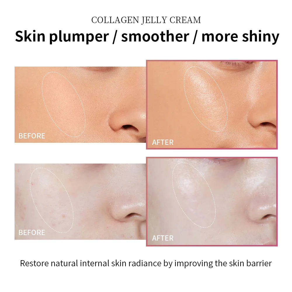 Collagen Jelly Face Cream – Anti-Aging, Firming & Deep Hydration